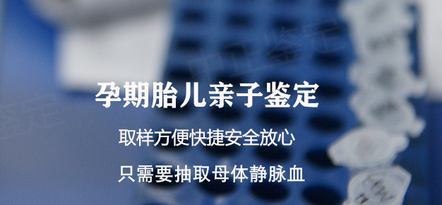 南通产前亲子鉴定怎么做,南通孕期亲子鉴定准确率高吗